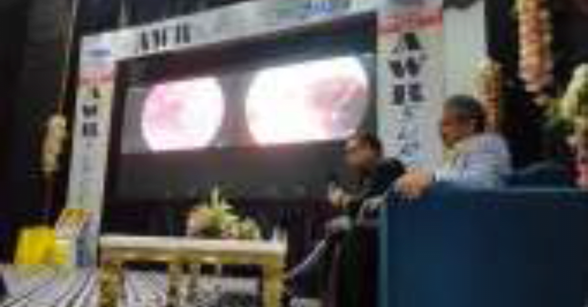 हैलट में पहली बार ई-टेप तकनीक सेहार्निया का ऑपरेशन