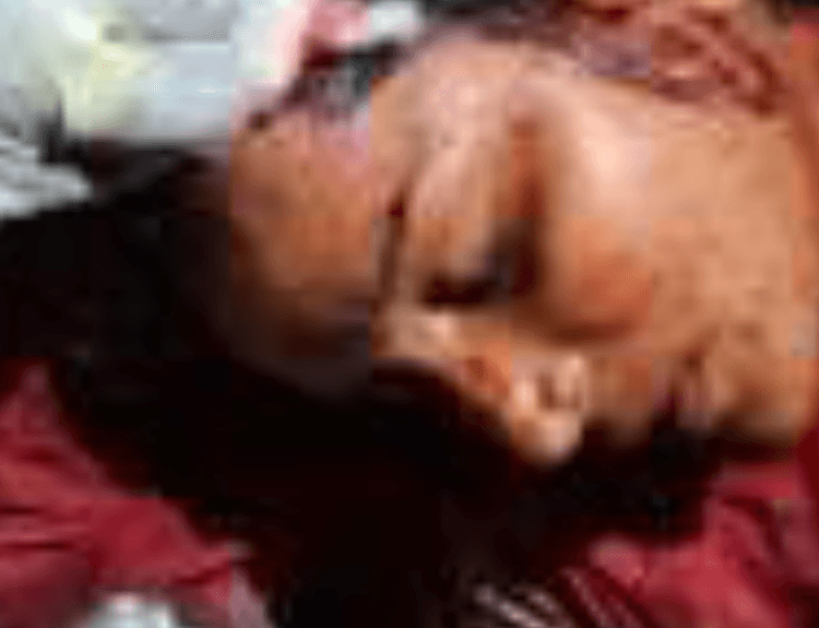दबंगों ने महिला पर धारदार हथियार से किया हमला, कपड़े फाड़े