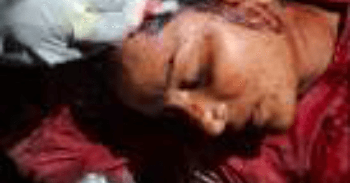 दबंगों ने महिला पर धारदार हथियार से किया हमला, कपड़े फाड़े