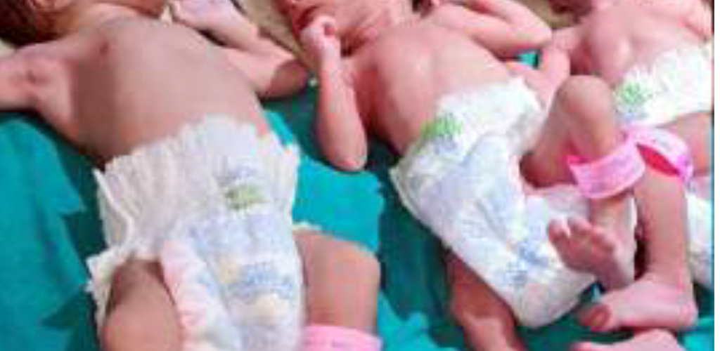 महिला ने एक साथ तीन पुत्रों को दिया जन्म जीवन दीप हॉस्पिटल की डाक्टरा शमीम ने कराया सुरक्षित प्रसव