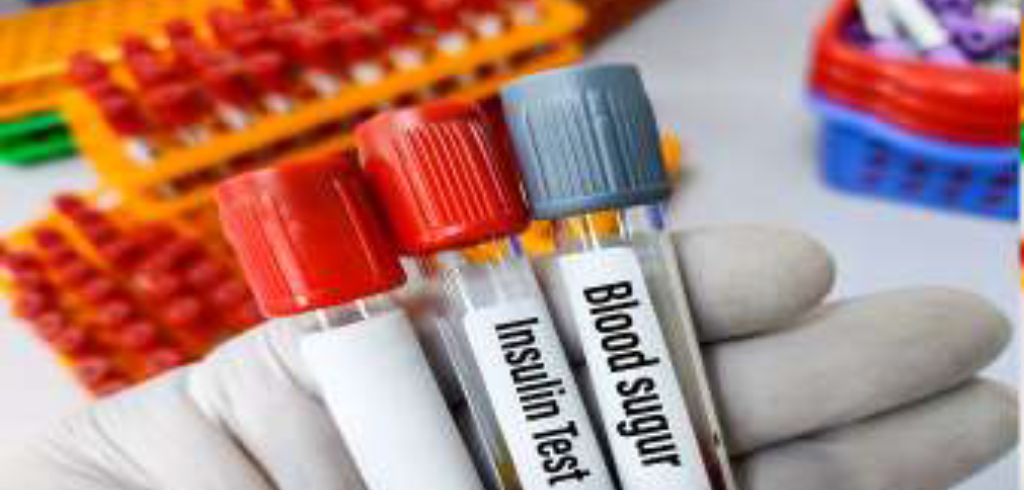 नाश्ता छोड़ा तो काबू में आ गई डायबिटीज, जीएसवीएम के अध्ययन में सामने आए चौंकाने वाले खुलासे